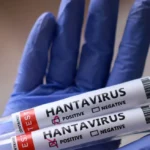 El Ministerio de Salud santafesino confirmó el primer caso de hantavirus en la provincia en lo que va del año